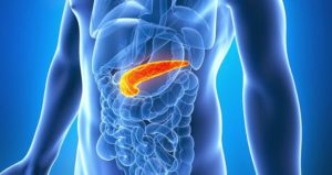 Pancreatite Aguda: diagnóstico e tratamento
