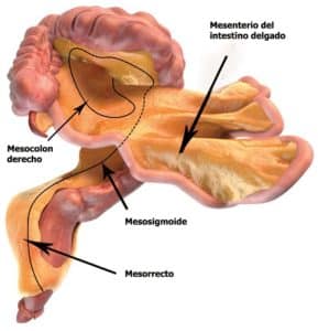 Paniculite Mesentérica: sintomas e tratamento
