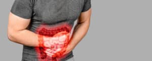 Doença de Crohn: o que é?